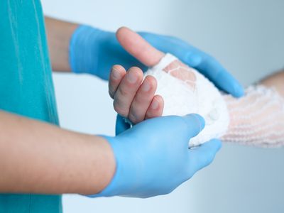 close up of doctor bandaging one hand