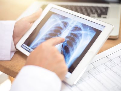 closeup of a young caucasian doctor man sitting at his office desk observing a chest radiograph in a tablet computer