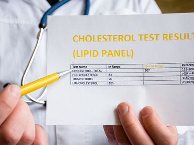 Close up of person in white coat showing results of cholesterol test on paper pen pointing to out of range high level of total cholesterol