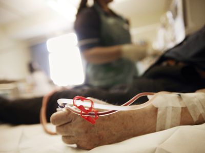 A patient going through kidney dialysis