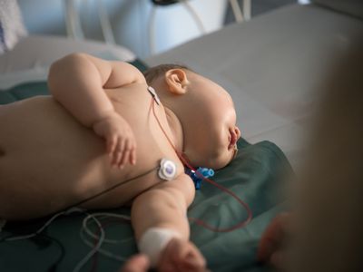 Baby in hospital bed with ECG attached