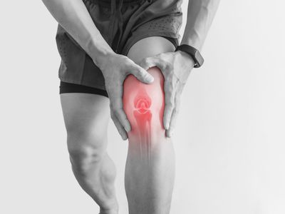 arthritic knee