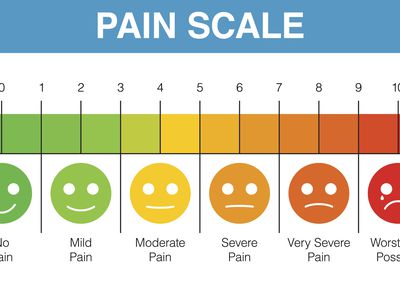 Pain rating scale chart