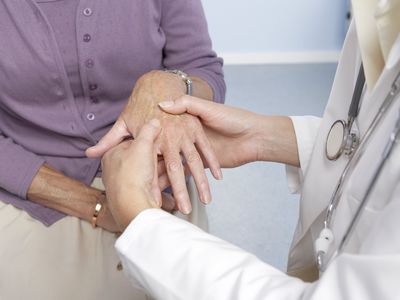 Rheumatoid arthritis, general practitioner examining patient and hand for signs of rheumatoid arthri : Stock Photo CompAdd to Board Caption:Rheumatoid arthritis. General practitioner examining a patient's hand for signs of rheumatoid arthritis. This condition is caused by the immune system attacking the body's own tissues, causing progressive joint and cartilage destruction. As the cartilage is worn away, new bone grows as part of the repair process. This causes stiffness and deformity of the fingers. Treatment is with anti-inflammatory drugs and physiotherapy. Rheumatoid arthritis, general practitioner examining patient and hand for signs of rheumatoid arthritis