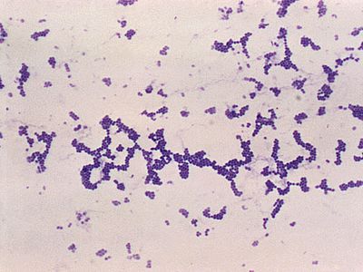 Gram-positive Staphylococcus aureus Bacteria