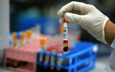 Israeli Laboratory Leads Western World In Blood Testing