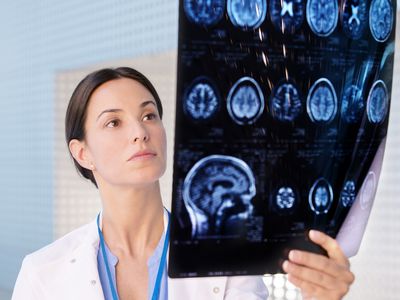 A neurologist examines a brain scan.