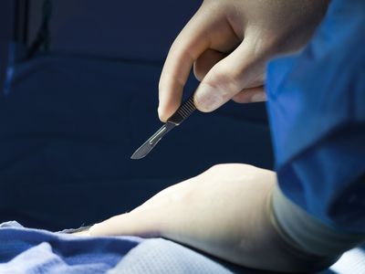 Surgeon Beginning Procedure With Scalpel In Hand, Close-up