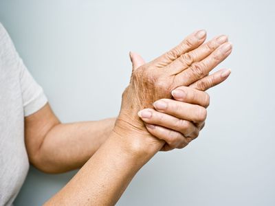 Elderly woman with Arthritis in her hands TIME health stock