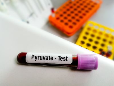 Blood sample for pyruvate test