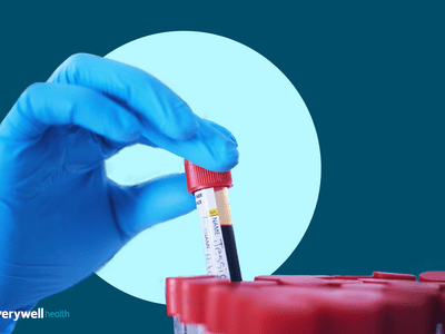 liquid biopsy for pancreatic cancer